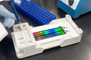 Medicare approves WashU Medicine’s whole-genome test for blood cancers