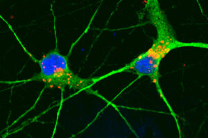 Chemical compound clears cellular waste, protects neurons in model of frontotemporal dementia