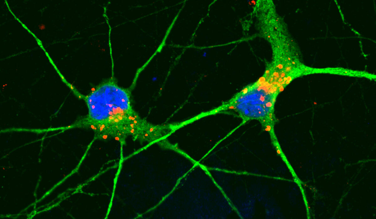 Chemical compound clears cellular waste, protects neurons in model of frontotemporal dementia