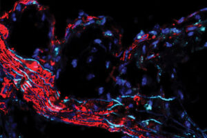 Mouse Aorta Plaque - Stitziel Lab