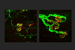 New strategy shows potential to block nerve loss in neurodegenerative diseases