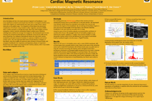20. Resolving and Visualizing Irregular Heartbeats Measured by Cardiac Magnetic Resonance