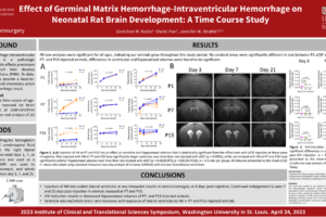 3. Effect of Germinal Matrix Hemorrhage-Intraventricular Hemorrhage on Neonatal Rat Brain Development: A Time Course Study